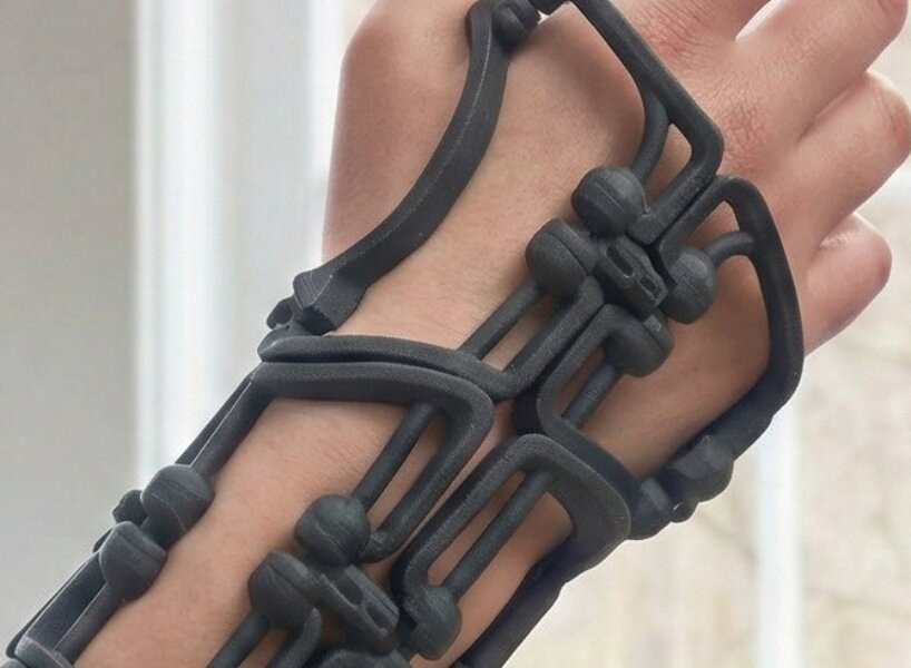 Bracesys: Katlanabilir Atel, İyileşme Konforunu Yeniden Tanımlıyor