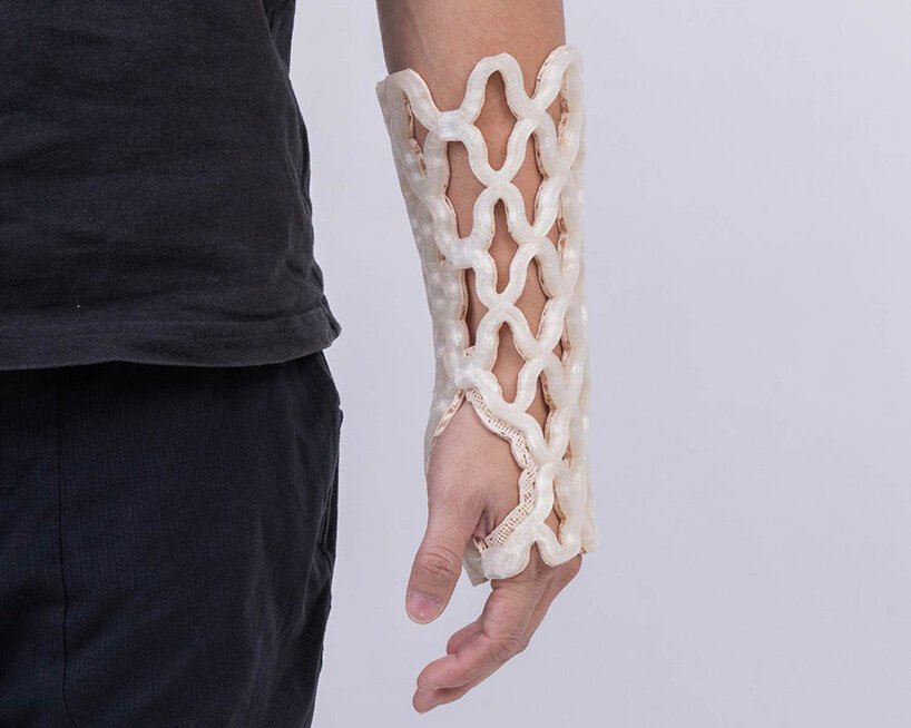 Castomize: 4D Baskı ile Ortopedide Nefes Alan Devrim Başladı