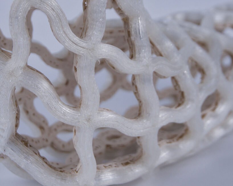Castomize: 4D Baskı ile Ortopedide Nefes Alan Devrim Başladı